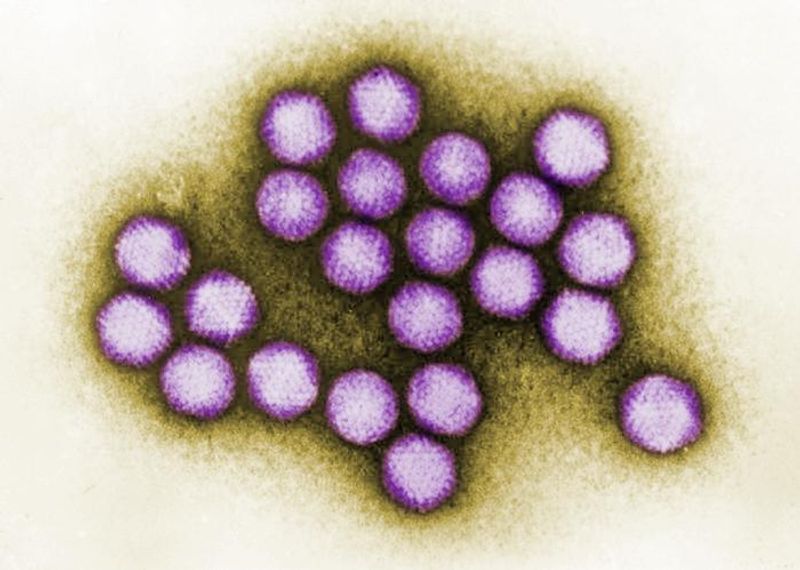 Purple adenovirus virions under a transmission electron microscope