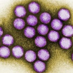 Purple adenovirus virions under a transmission electron microscope