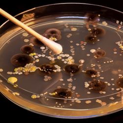 Petri dish on a black background, containing multiple bacterial and fungal cultures that appear as yellow and beige spots and brown furry areas; a cotton swab is being applied to the plate