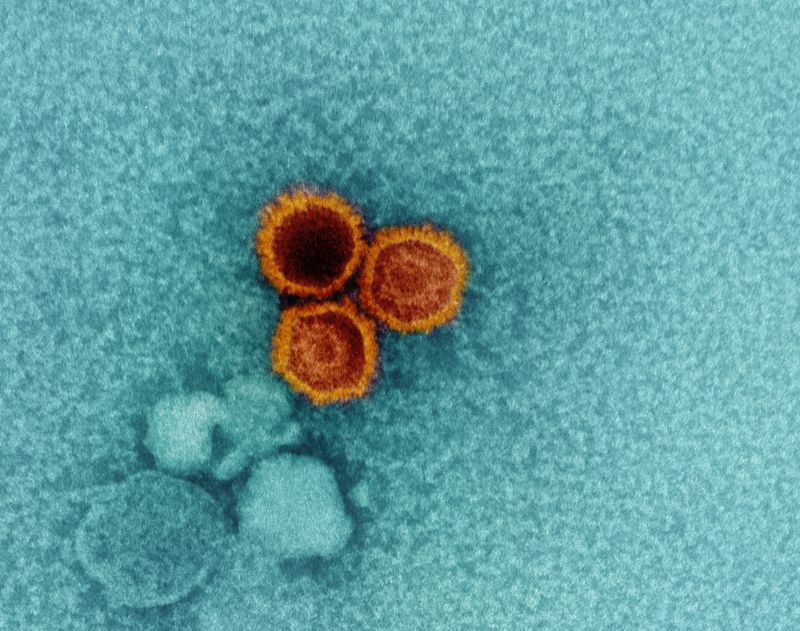 An electron micrograph showing three EBV virions in red-orange against a teal-blue background