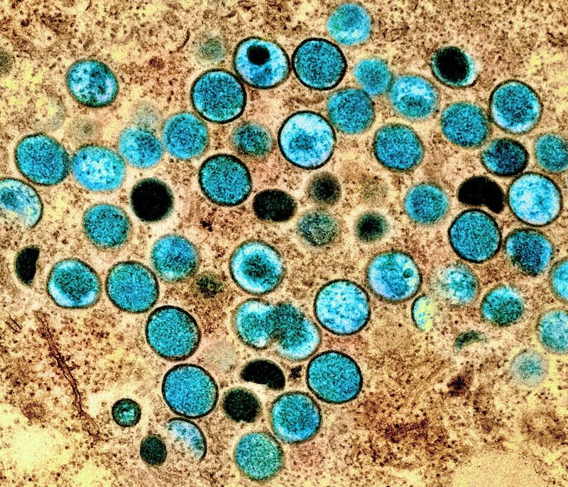 colorized transmission electron microscopic image of mpox virus particles (teal), which were found within an infected cell (brown), having been cultured in the laboratory. 