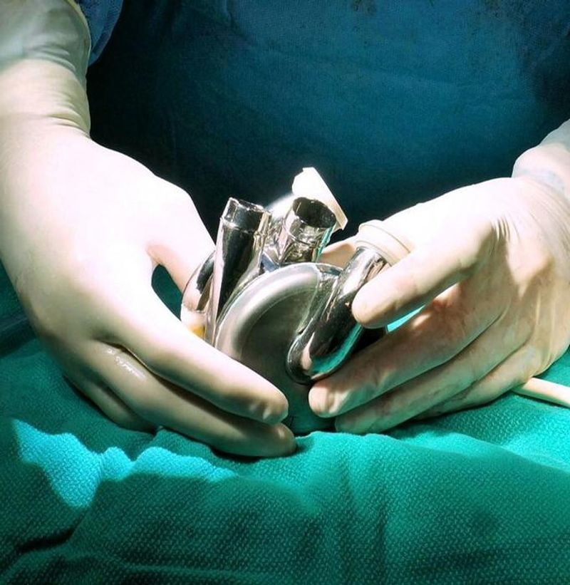 Photograph of the shiny titanium BiVACOR® Total Artificial Heart, grasped by two white latex-gloved hands, resting on a turquoise sheet