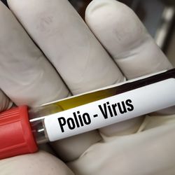 Polio lab leak