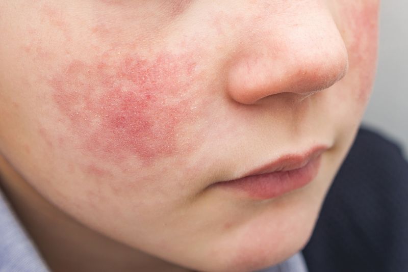 close up of boy with red cheeks