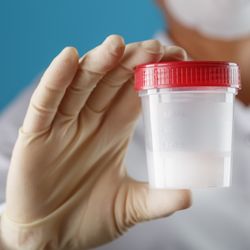 doctor wearing white mask and white shirt holds semen sample in clear containing with red lid; doctor is wearing a white glove, the semen sample is clearly in focus