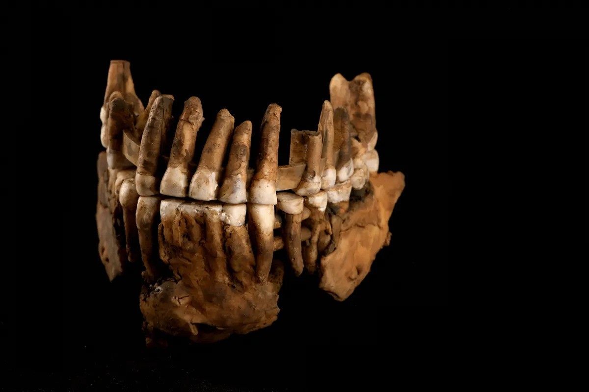 The maxillary bone of Neanderthal Thorin