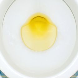 White toilet bowl filled with yellow urine