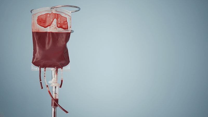 A bag of blood for transfusion.