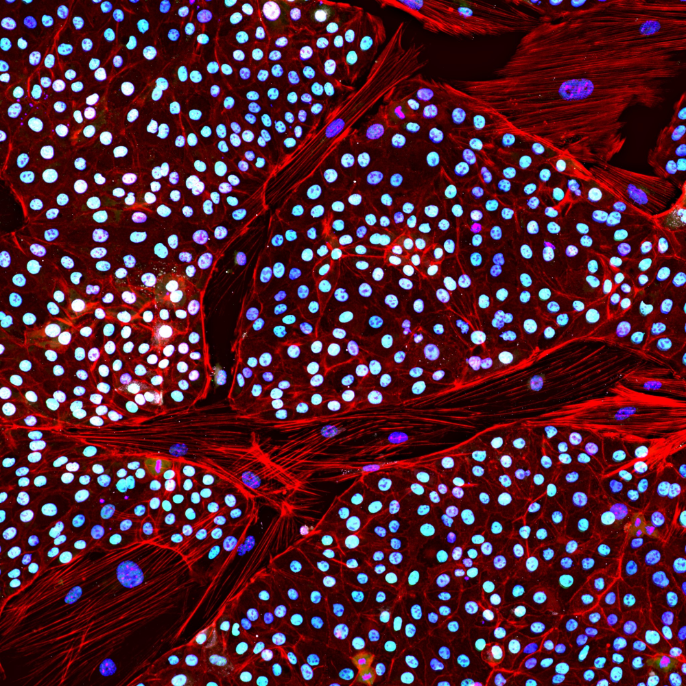 elephant induced pluripotent stem cell