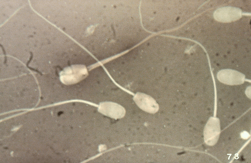 Microscopic examination of ram's semen cells smear.